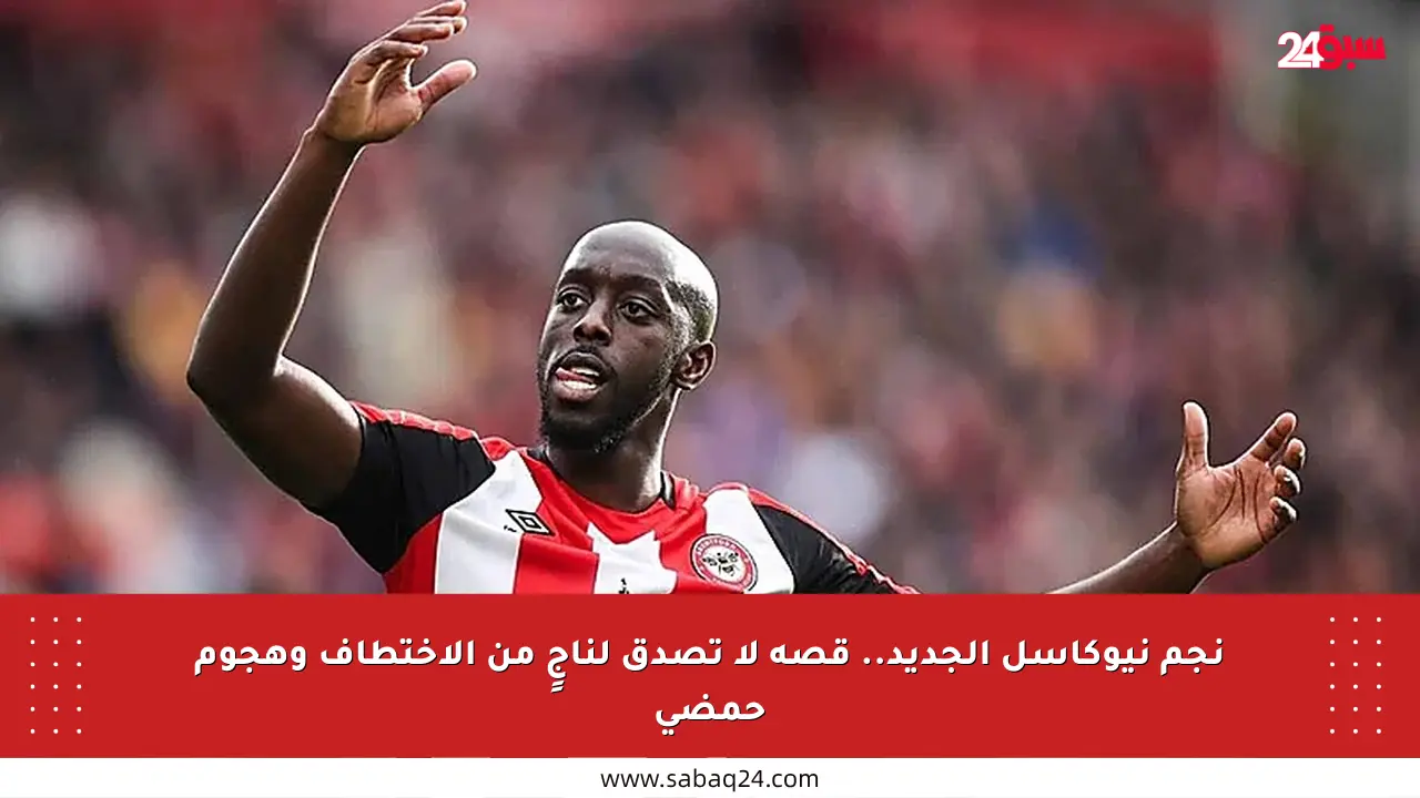 نجم نيوكاسل الجديد.. قصة لا تصدق لناجٍ من الاختطاف وهجوم حمضي